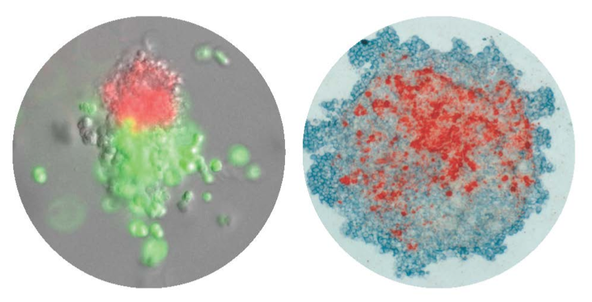 CFU-Mk/E: Colonies derived from a single cell that differentiated down the megakaryocytic and erythroid lineages. Left: Immunofluorescence, Right: Immunohistochemistry.